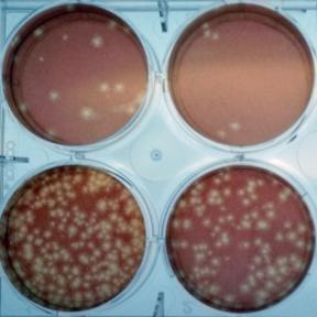 Plaque reduction neutralization test