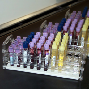 Biomonitoring - tubes containing blood and urine