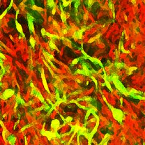 Biofilms of Mycobacterium smegmatis cells - Ojha Laboratory