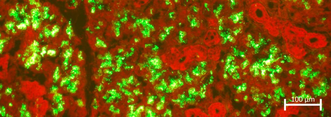 salivary gland containing rabies virus